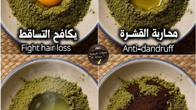 الحناء وفوائدها للشعر وفروة الرأس هل تساعد في محاربة القشرة وتساقط الشعر؟