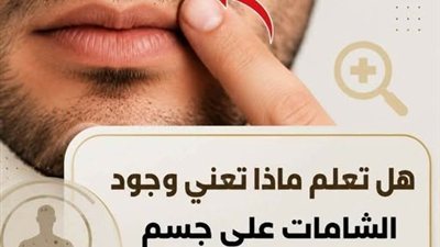 هل تعلم ماذا تعني وجود الشامات على الوجه ؟
