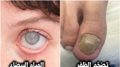 4 مشكلات صحية 
