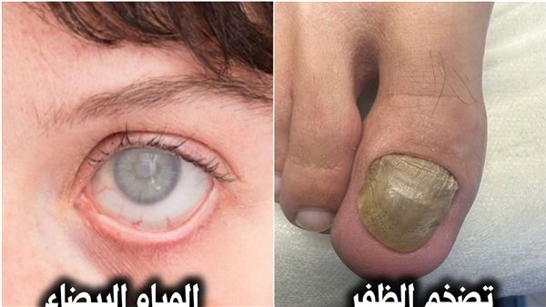 لمحة نيوز