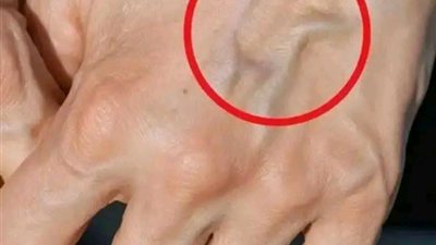 إذا كانت عـروقك بارزة سواء كنت صغير او كبير في السن فهذا يعني أنك