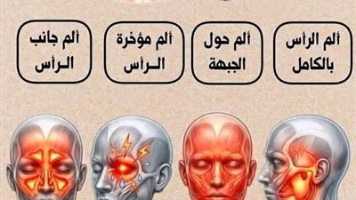  ألم الرأس بالكامل : يثار بسبب الأطفال يومياً  ألم حول الجبهة : بسبب شعور …عرض المزيد