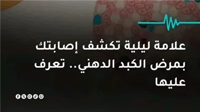 هناك علامة تظهر على اليدين والقدمين ليلًا تدل على الإصابة بمرض الكبد الدهني.. تعرف على المزيد