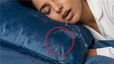 سيلان اللعاب أثناء النوم