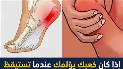 الم الكعب عند الاستيقاظ