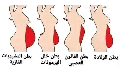 أسباب بروز البطن وأنواعه