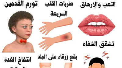 تشقق الشـفاه وآلام الراس بسبب…