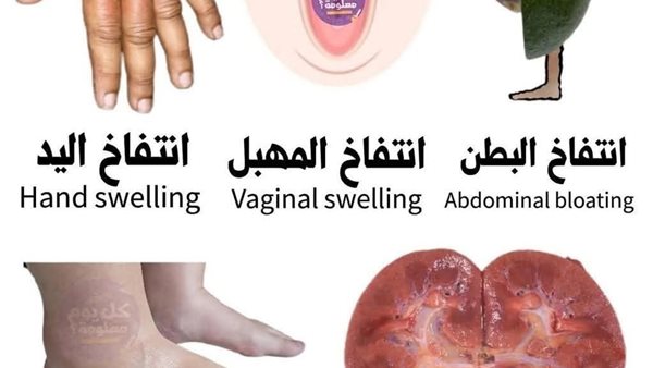 لمحة نيوز