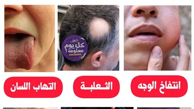 علاجات لهذه الامراض 