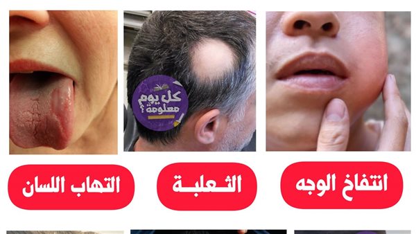 لمحة نيوز