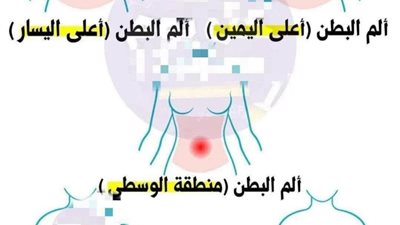 ألـم البطن