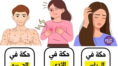 الرائحة والحكة