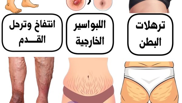 لمحة نيوز