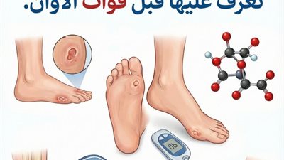علامات ارتفاع السكر فى الدم