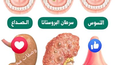 خمس حبات زبيب
