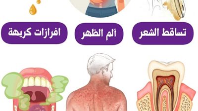 تساقط الشعر بسبب التوتر الغدة الدرقية  حبوب منع الحمل