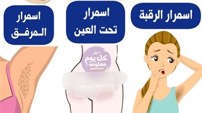 اسباب اسمرار الرقبة اسمرار تحت العين  اسمرار المرفق  اسمرار الإبـط 