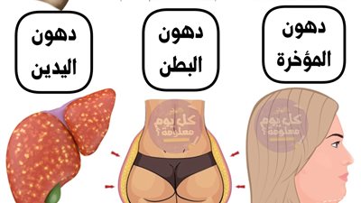 دهون الأرداف دهون البطن دهون المؤخرة دهون الكبد  دهون الوجه - دهون اليدين 
