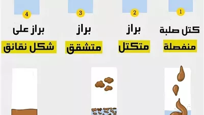 كتل صلبة منفصلة إمساك شديد
