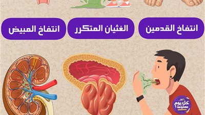 انتفاخ القدمين الغثيان المتكرر انتفاخ المبيض رائحة الفم تضخم الكلى تضخم البروستاتا