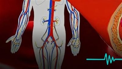 تظهر عليك عند المشي  4 علامات لارتفاع الكوليسترول احذرها !